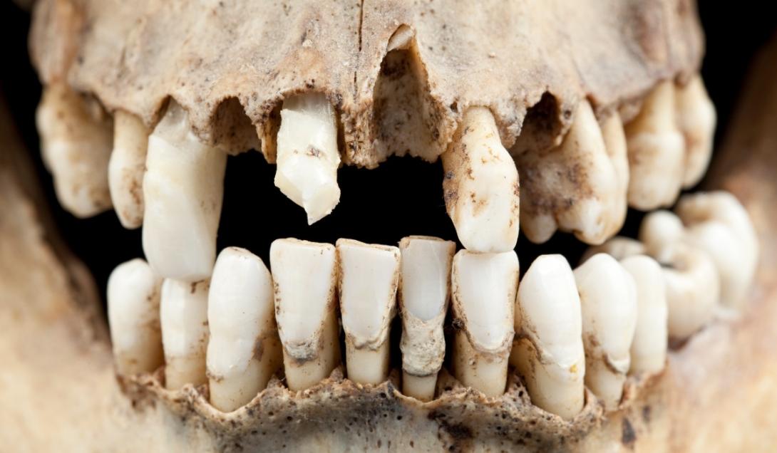 Bacterias dentales de los neandertales servirían para desarrollar antibióticos asombrosos-0